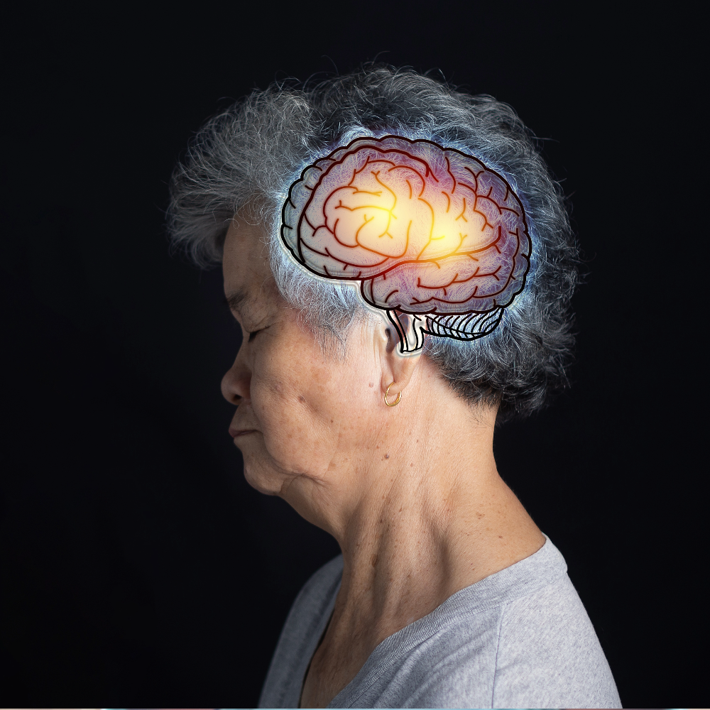 Profile of an older woman with an overlay of a brain.