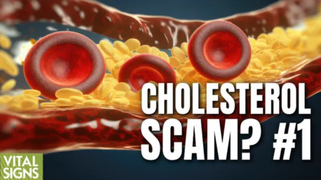 Cholesterol Scam? 1